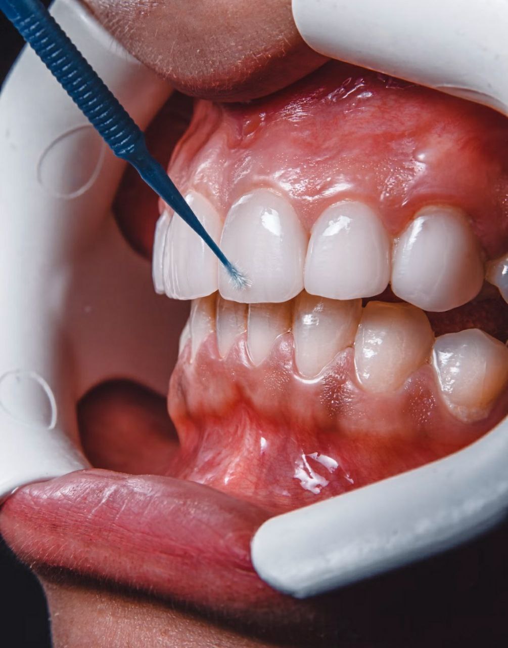oral mucosal layer
